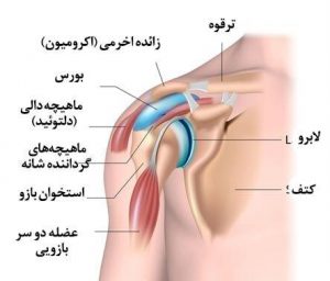 دررفتگی مفصل شانه